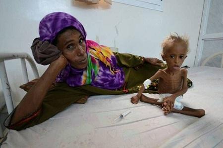 سازمان ملل: 20 میلیون یمنی در خطر گرسنگی هستند